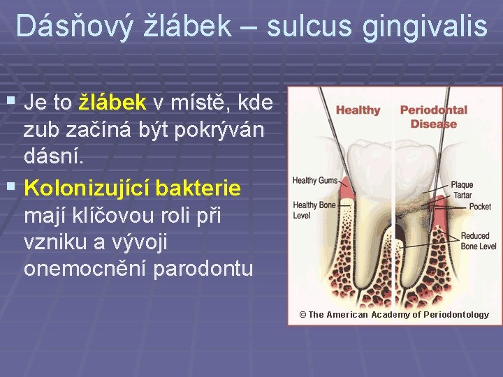Dásňový žlábek – sulcus gingivalis § Je to žlábek v místě, kde zub začíná