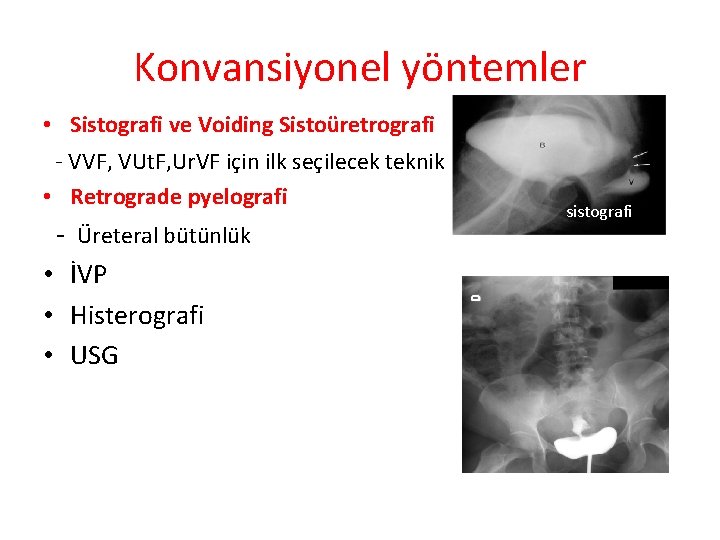 Konvansiyonel yöntemler • Sistografi ve Voiding Sistoüretrografi - VVF, VUt. F, Ur. VF için Konvansiyonel yöntemler • Sistografi ve Voiding Sistoüretrografi - VVF, VUt. F, Ur. VF için