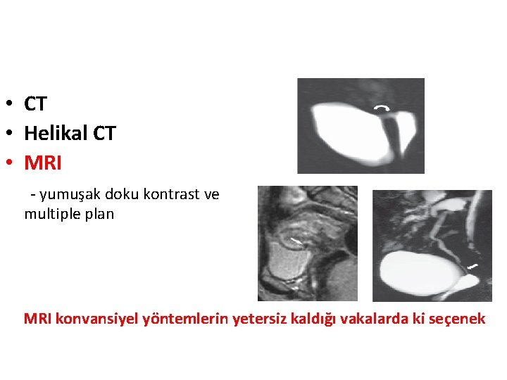  • CT • Helikal CT • MRI - yumuşak doku kontrast ve multiple