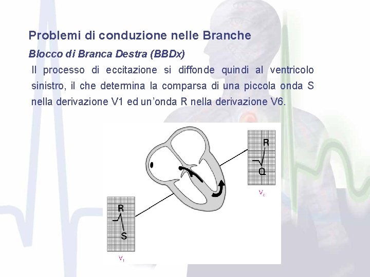 Problemi di conduzione nelle Branche Blocco di Branca Destra (BBDx) Il processo di eccitazione