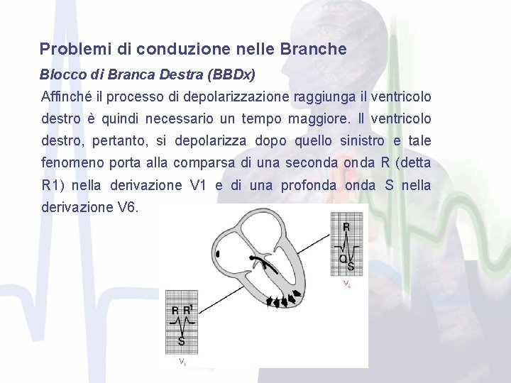 Problemi di conduzione nelle Branche Blocco di Branca Destra (BBDx) Affinché il processo di