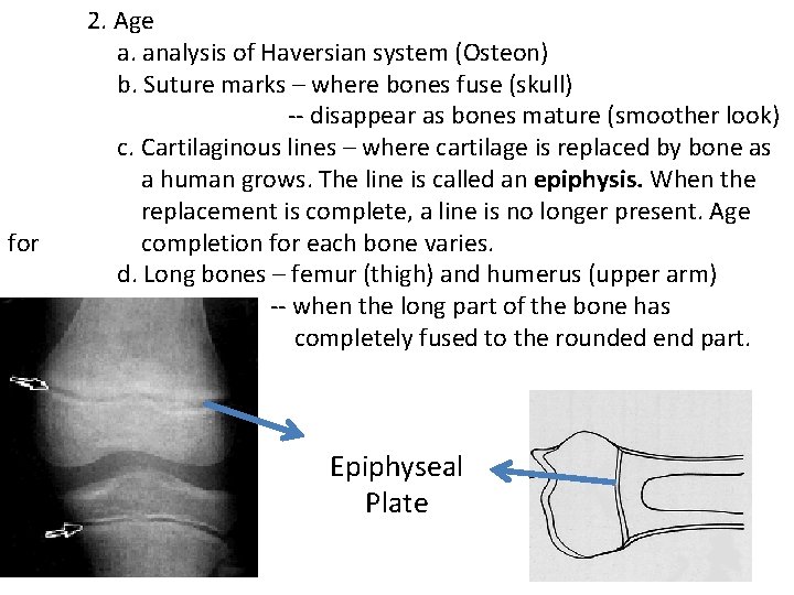 for 2. Age a. analysis of Haversian system (Osteon) b. Suture marks – where