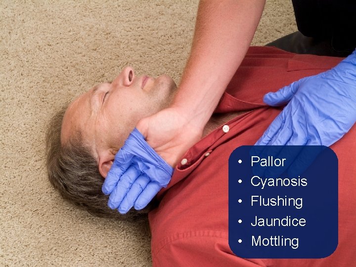 • • • Pallor Cyanosis Flushing Jaundice Mottling • • • Pallor Cyanosis Flushing Jaundice Mottling