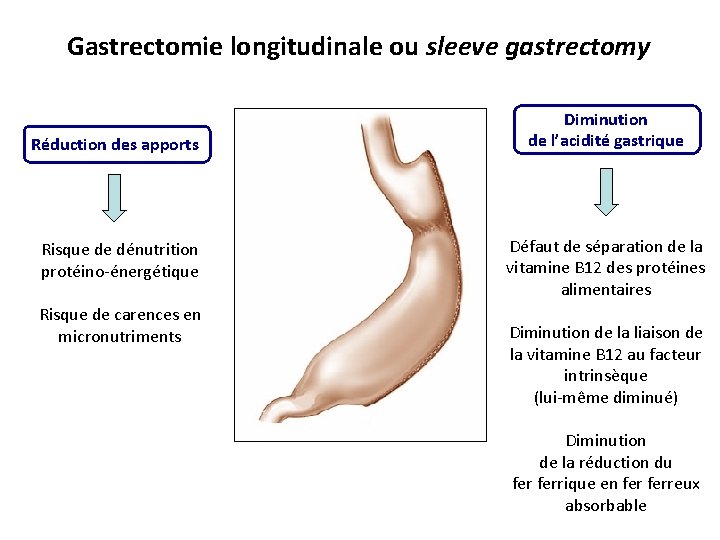 Gastrectomie longitudinale ou sleeve gastrectomy Réduction des apports Risque de dénutrition protéino-énergétique Risque de