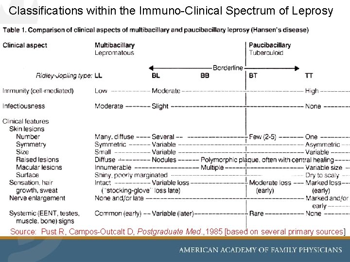 Classifications within the Immuno-Clinical Spectrum of Leprosy Source: Pust R, Campos-Outcalt D, Postgraduate Med.