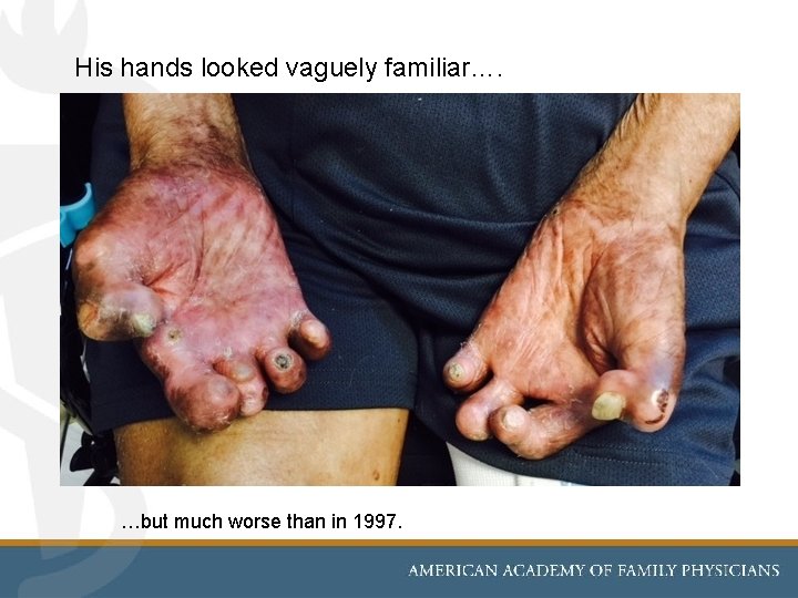 His hands looked vaguely familiar…. …but much worse than in 1997. 