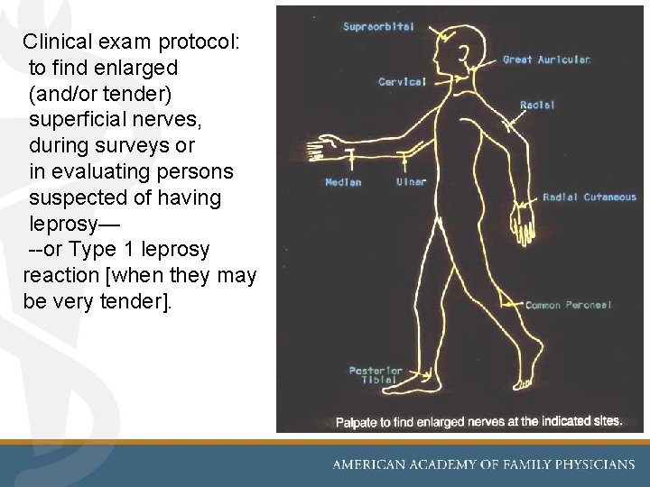 Clinical exam protocol: to find enlarged (and/or tender) superficial nerves, during surveys or in