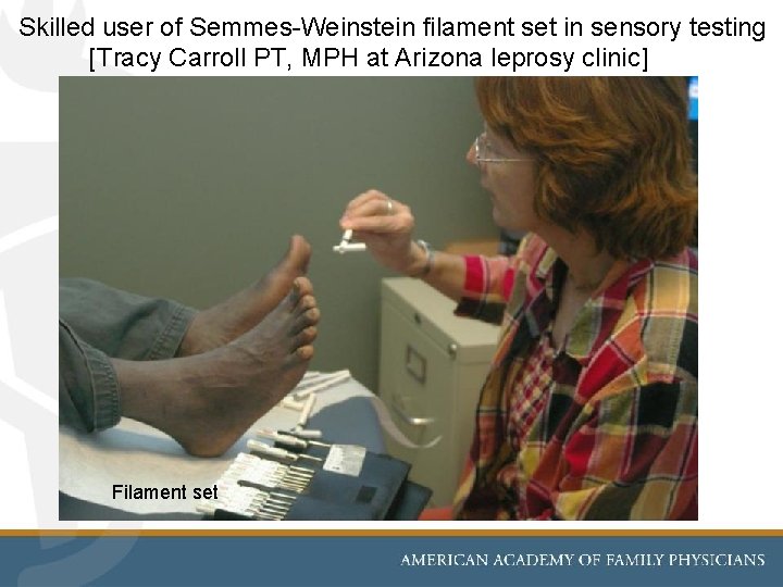  Skilled user of Semmes-Weinstein filament set in sensory testing [Tracy Carroll PT, MPH