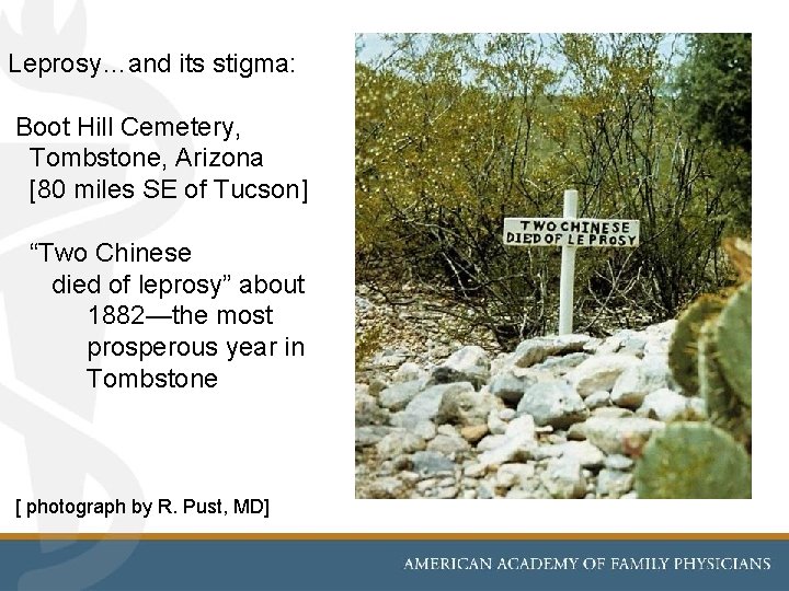 Leprosy…and its stigma: Boot Hill Cemetery, Tombstone, Arizona [80 miles SE of Tucson] “Two
