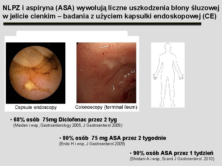 NLPZ i aspiryna (ASA) wywołują liczne uszkodzenia błony śluzowej w jelicie cienkim – badania