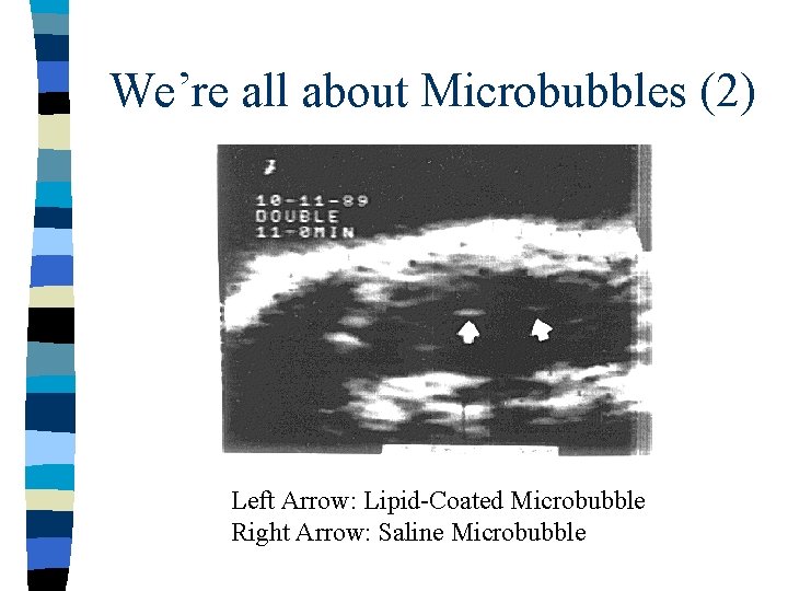 We’re all about Microbubbles (2) Left Arrow: Lipid-Coated Microbubble Right Arrow: Saline Microbubble 