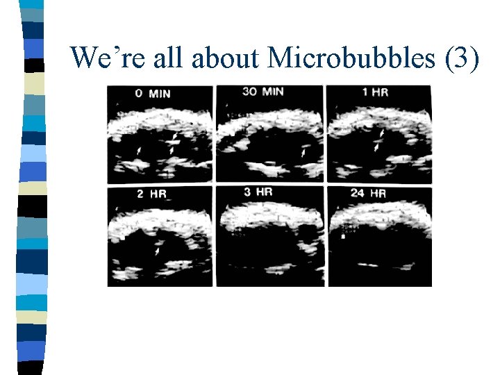 We’re all about Microbubbles (3) 