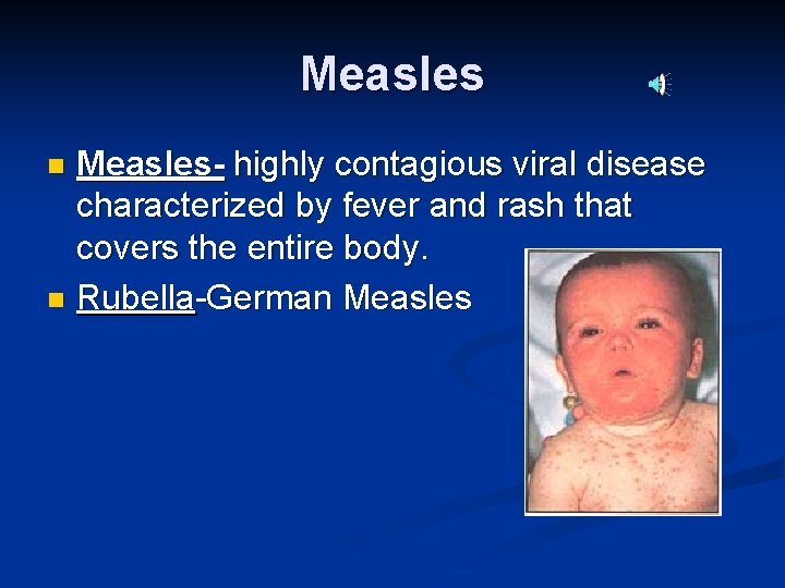 Measles- highly contagious viral disease characterized by fever and rash that covers the entire