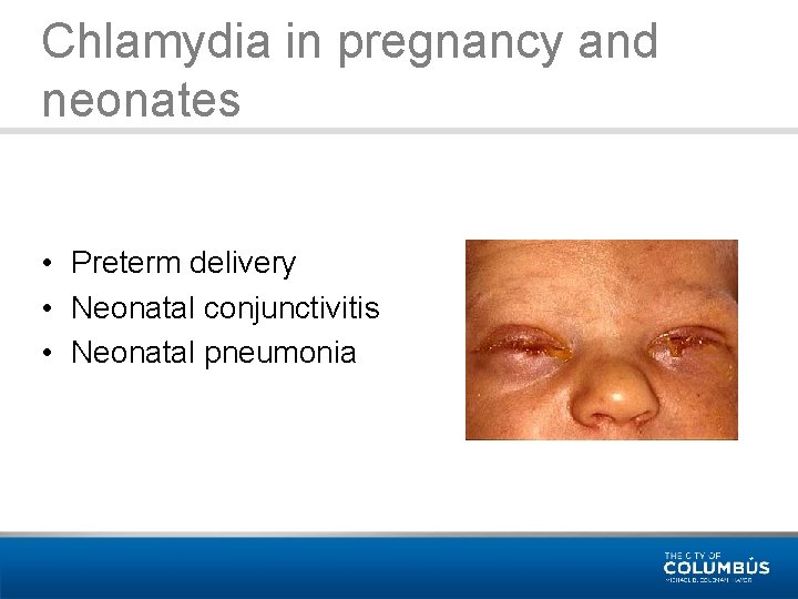 Chlamydia in pregnancy and neonates • Preterm delivery • Neonatal conjunctivitis • Neonatal pneumonia