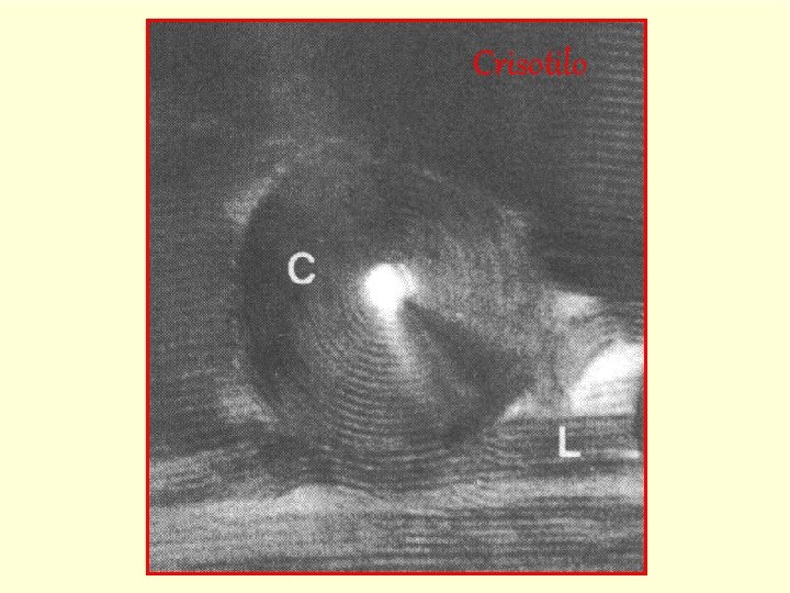 Crisotilo 