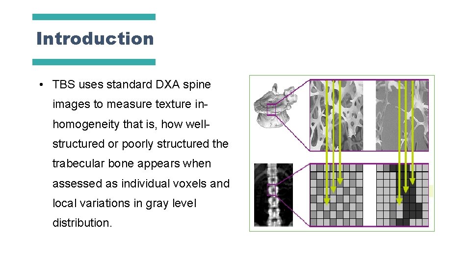 Introduction • TBS uses standard DXA spine images to measure texture inhomogeneity that is,