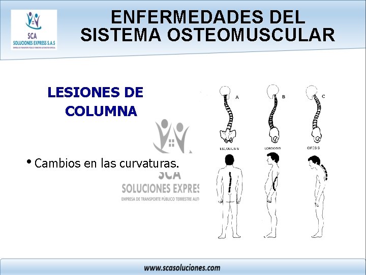 ENFERMEDADES DEL SISTEMA OSTEOMUSCULAR LESIONES DE COLUMNA i. Cambios en las curvaturas. 