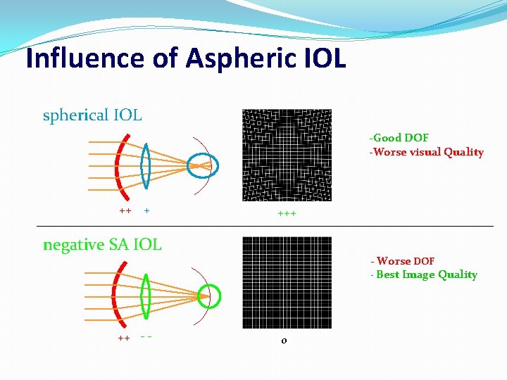 Influence of Aspheric IOL spherical IOL -Good DOF -Worse visual Quality ++ + +++