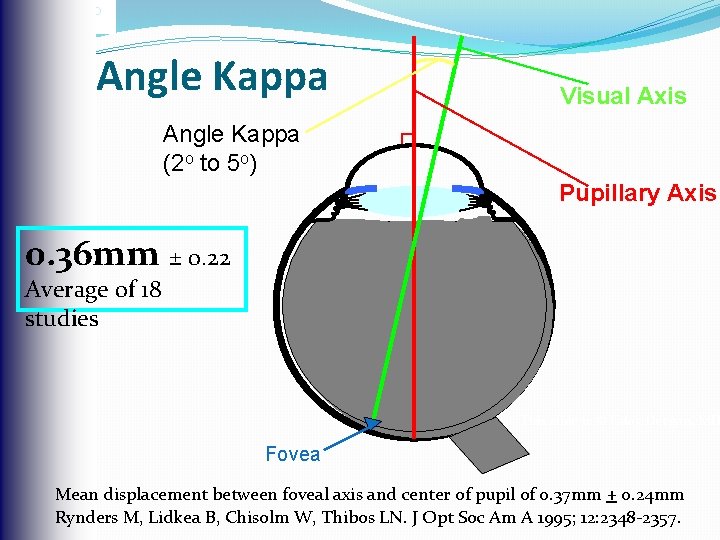 Uday Devgan, MD devgan@ucla. edu Angle Kappa Visual Axis Angle Kappa (2 o to