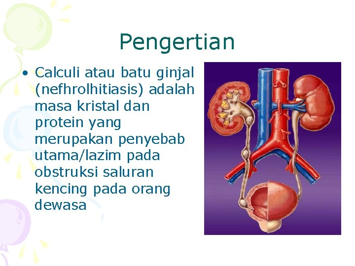 Pengertian • Calculi atau batu ginjal (nefhrolhitiasis) adalah masa kristal dan protein yang merupakan