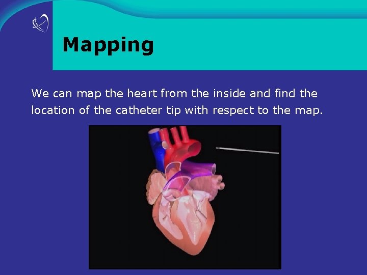 Mapping We can map the heart from the inside and find the location of