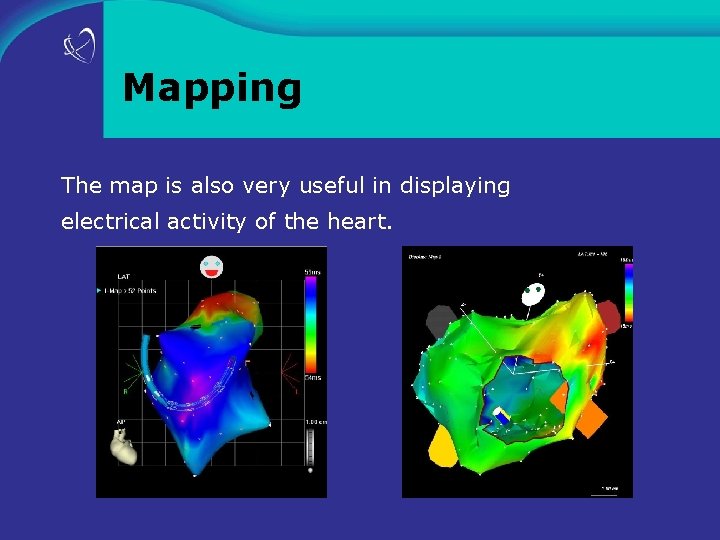 Mapping The map is also very useful in displaying electrical activity of the heart.