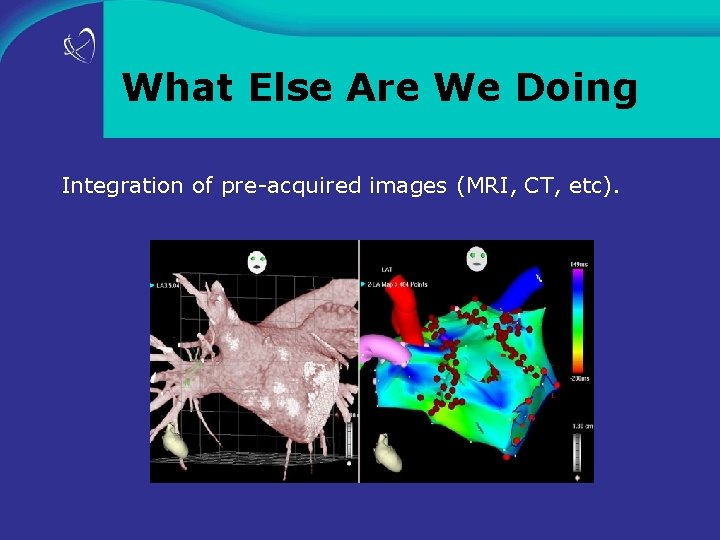 What Else Are We Doing Integration of pre-acquired images (MRI, CT, etc). 
