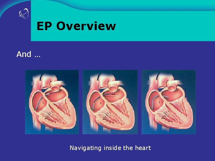 EP Overview And … Navigating inside the heart 