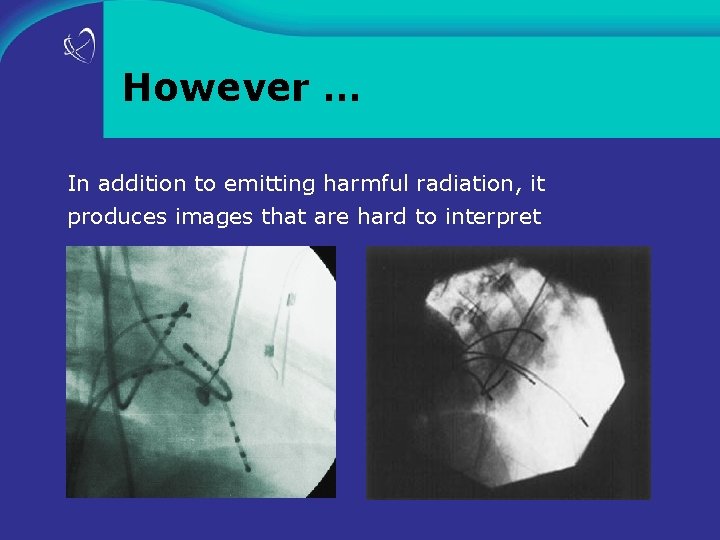 However … In addition to emitting harmful radiation, it produces images that are hard