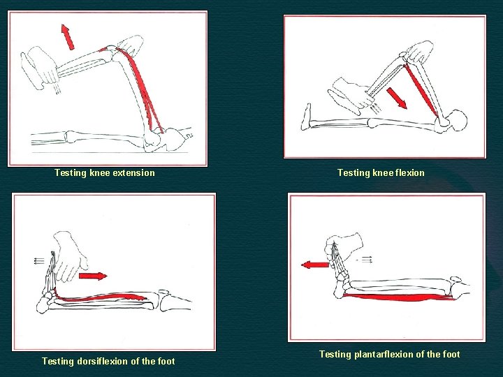 Testing knee extension Testing dorsiflexion of the foot Testing knee flexion Testing plantarflexion of