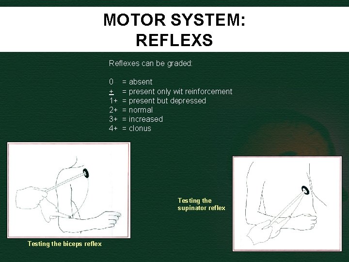 MOTOR SYSTEM: REFLEXS Reflexes can be graded: 0 + 1+ 2+ 3+ 4+ =