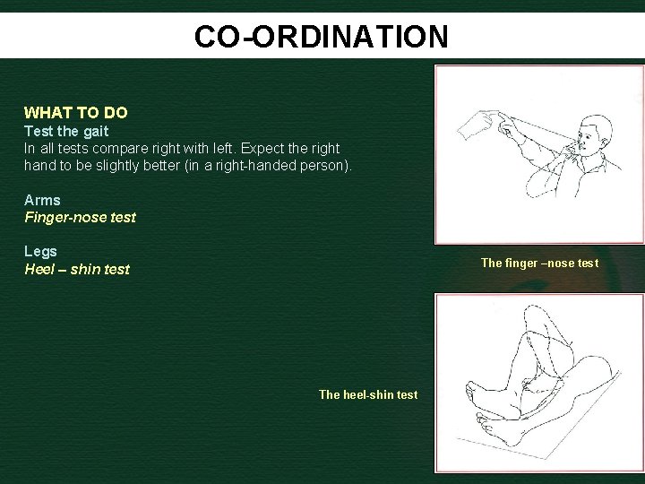 CO-ORDINATION WHAT TO DO Test the gait In all tests compare right with left.