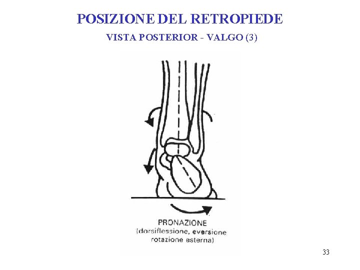 POSIZIONE DEL RETROPIEDE VISTA POSTERIOR - VALGO (3) 33 