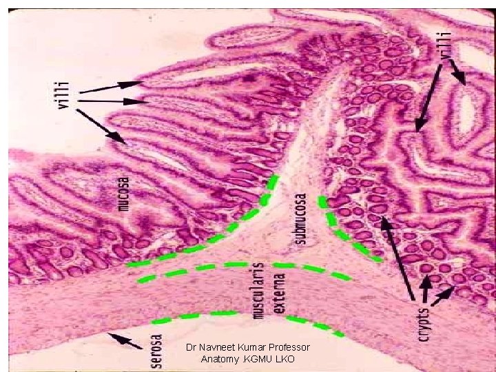 Dr Navneet Kumar Professor Anatomy. KGMU LKO 
