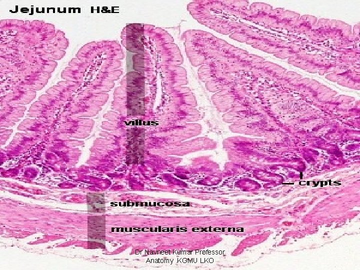 Dr Navneet Kumar Professor Anatomy. KGMU LKO 