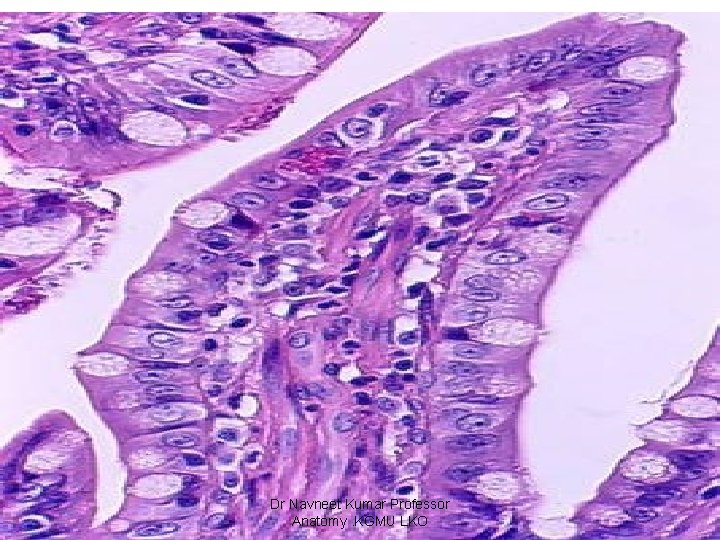 Dr Navneet Kumar Professor Anatomy. KGMU LKO 