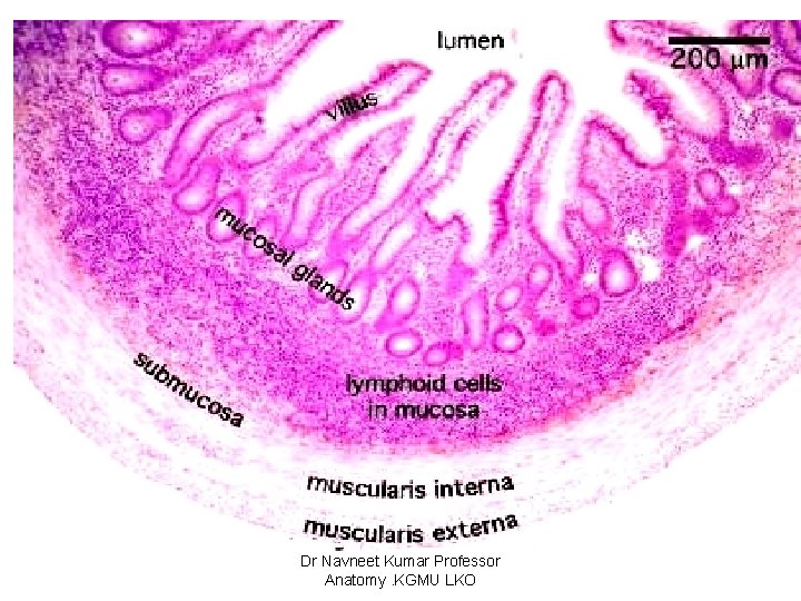 Small intestine -ileum Dr Navneet Kumar Professor Anatomy. KGMU LKO 