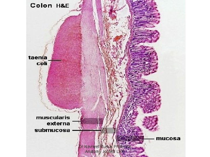 Dr Navneet Kumar Professor Anatomy. KGMU LKO 