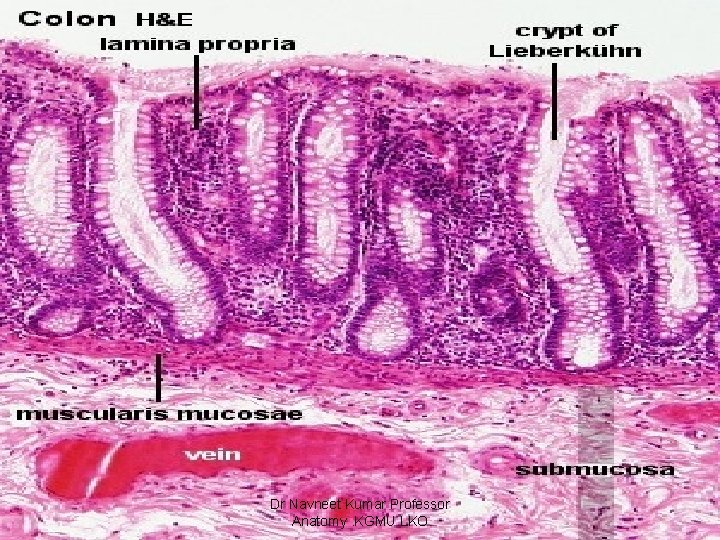 Dr Navneet Kumar Professor Anatomy. KGMU LKO 