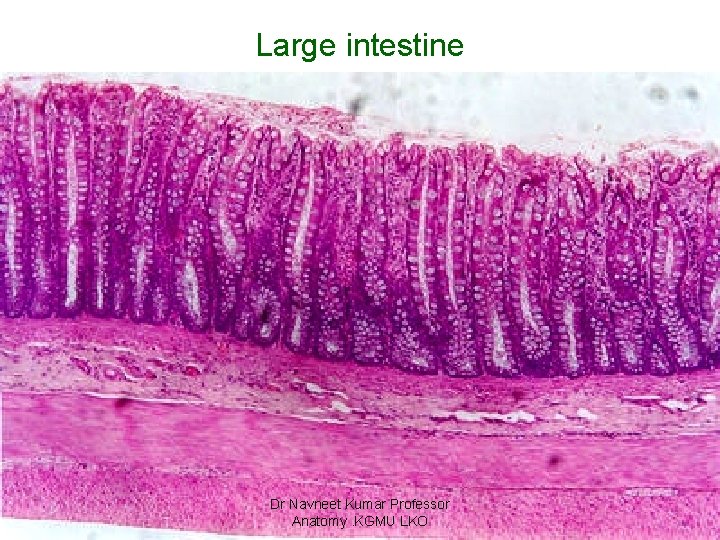 Large intestine Dr Navneet Kumar Professor Anatomy. KGMU LKO 