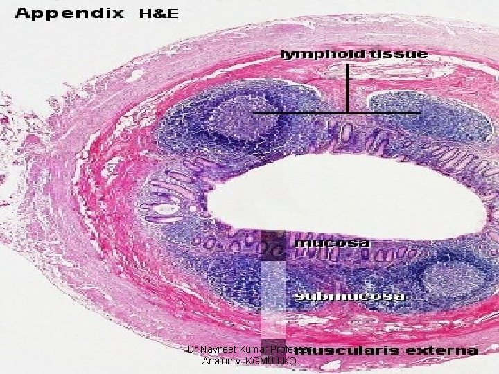 Dr Navneet Kumar Professor Anatomy. KGMU LKO 