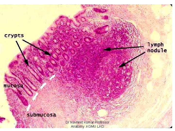 Appendix Dr Navneet Kumar Professor Anatomy. KGMU LKO 