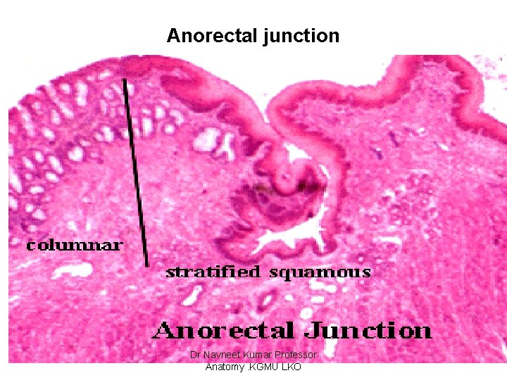 Anorectal junction Dr Navneet Kumar Professor Anatomy. KGMU LKO 