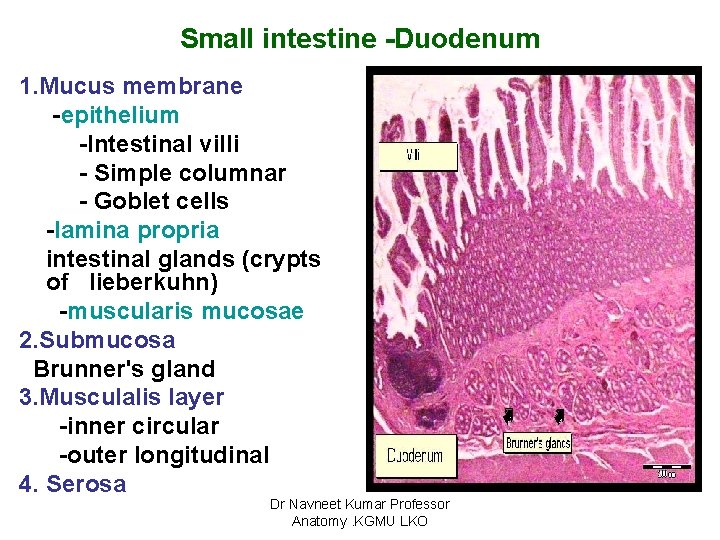 Small intestine -Duodenum 1. Mucus membrane -epithelium -Intestinal villi - Simple columnar - Goblet
