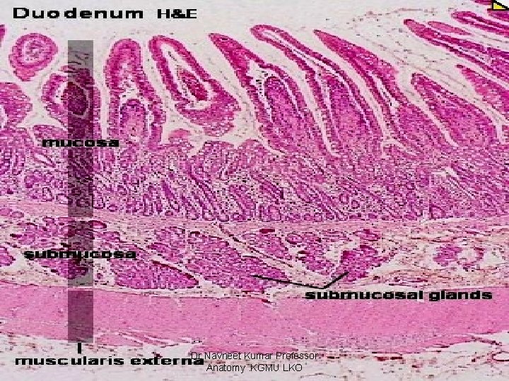 Dr Navneet Kumar Professor Anatomy. KGMU LKO 