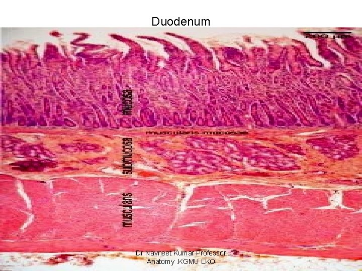 Duodenum Dr Navneet Kumar Professor Anatomy. KGMU LKO 