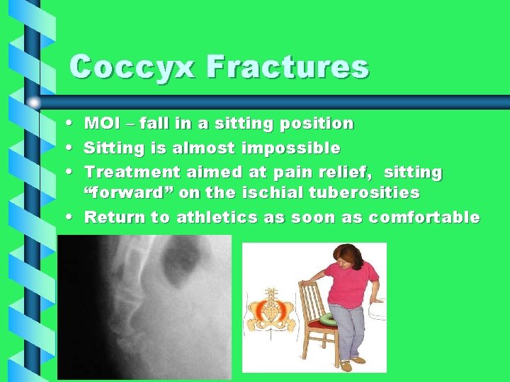 Coccyx Fractures • • • MOI – fall in a sitting position Sitting is