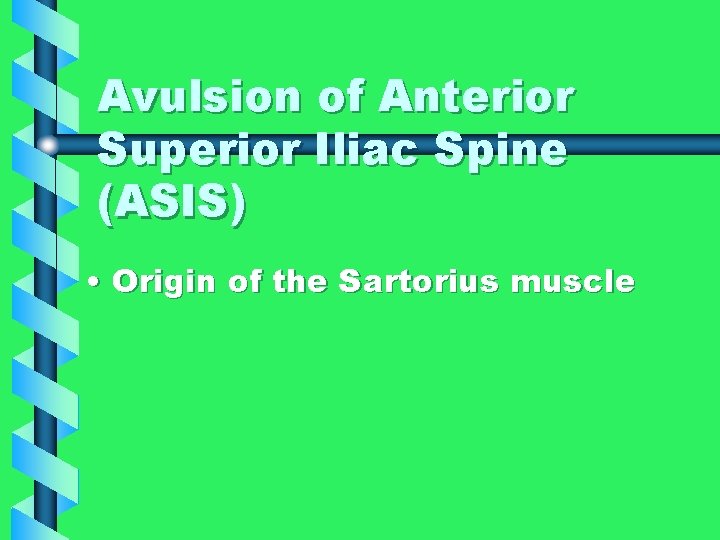 Avulsion of Anterior Superior Iliac Spine (ASIS) • Origin of the Sartorius muscle 