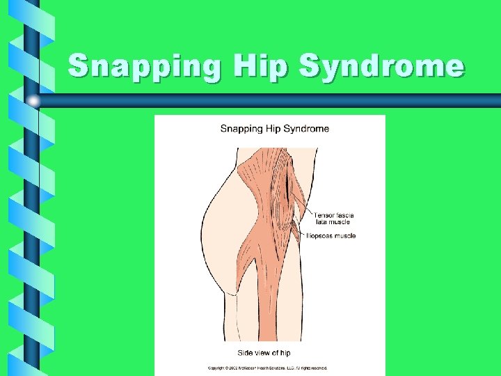 Snapping Hip Syndrome 