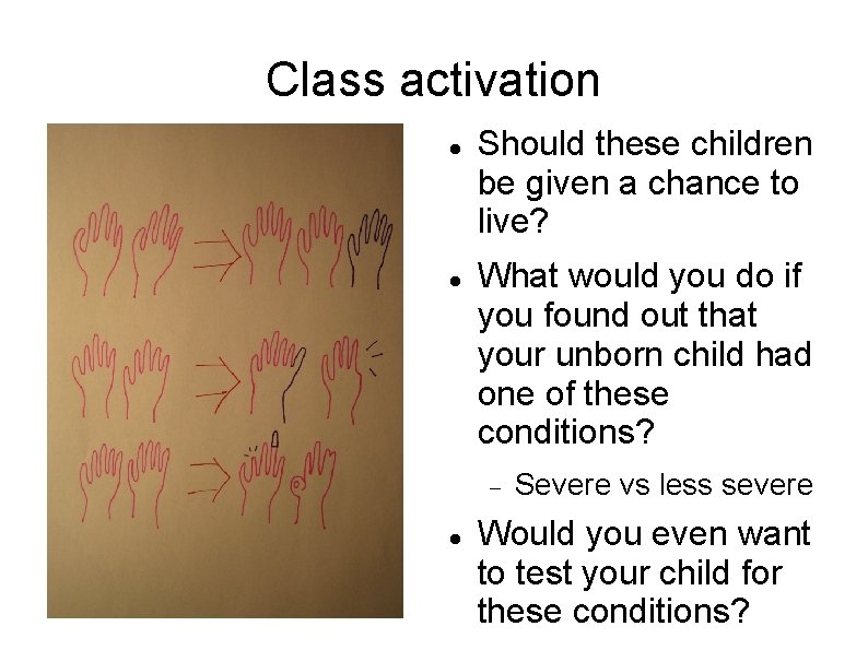 Class activation Should these children be given a chance to live? What would you